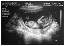 ultrasound-Jan22.jpg