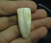 tooth1.JPG