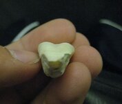 tooth5.JPG