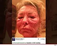 1126-roseanne-beaten-face-twitter-3.webp