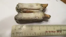 teeth 001.webp