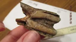teeth 003.webp