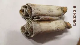teeth 004.webp