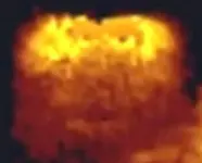 chestsonar.webp