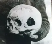 Ruth's Skull Small Hole2.webp