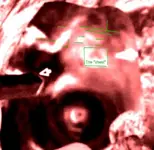 chestfromovehighlighted.webp