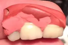 Grandma's Teeth.webp