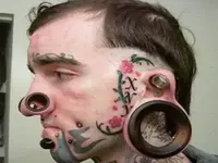 Nose-Gauging.webp