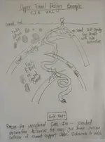 Upper Structure Design.webp