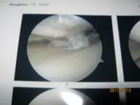 knee 002.webp