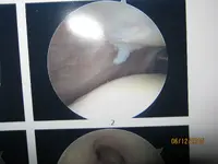 knee 001.webp