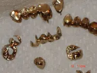 gold teeth.webp