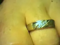 eye st pk.webp
