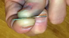 thumb image of coin and dime sideways view.webp
