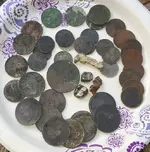 qrCoins teeth 1.webp