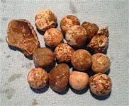Musket balls.webp Musket balls.webp