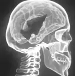 on the brain.webp