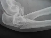 X-Ray 001.webp