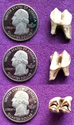 tooth.webp