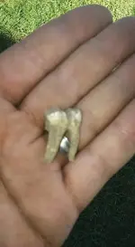 tooth.webp tooth.webp