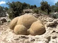 big_calc_concretion.webp
