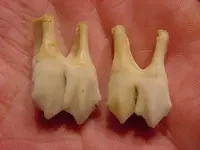 Teeth1.webp