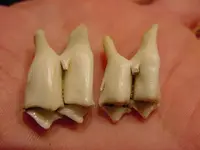 Teeth2.webp