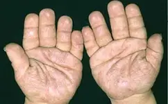 CalWqB0UUAAeFMI.webp