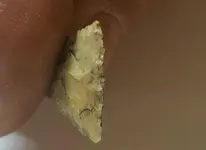 edge of arrow head.webp