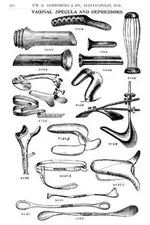 specula.webp