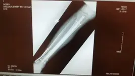 leg.webp leg.webp
