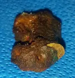 20170823_055242.webp