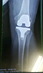Knee.webp
