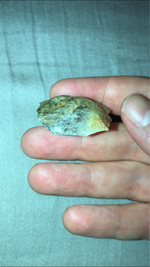 ImageUploadedByTreasureNet.com1522102940.209218.webp