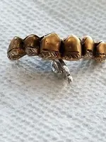 Gold Dentures 040618.webp