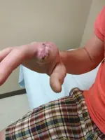 IMG952018062195085907.webp