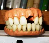 teeth2edited_edited-3.webp