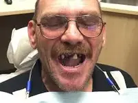 no dentist.webp
