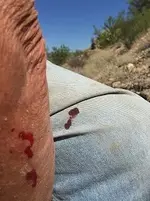 blood.webp