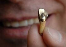 gold dental.jpg