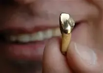 gold dental.jpg