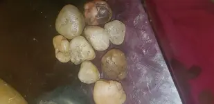 20181001_045600.webp