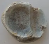 carpal bottom.webp