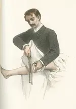 Ea19G_foot_amputation.webp