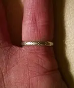 Ring - Finger.webp Ring - Finger.webp