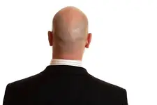 back of my head now.webp