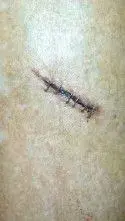 Big cut.webp