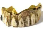 Dentures-front-150x113.webp