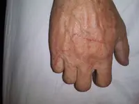 20190310_103243.webp