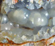 Botryoidal Quartz (Chalcedony).webp